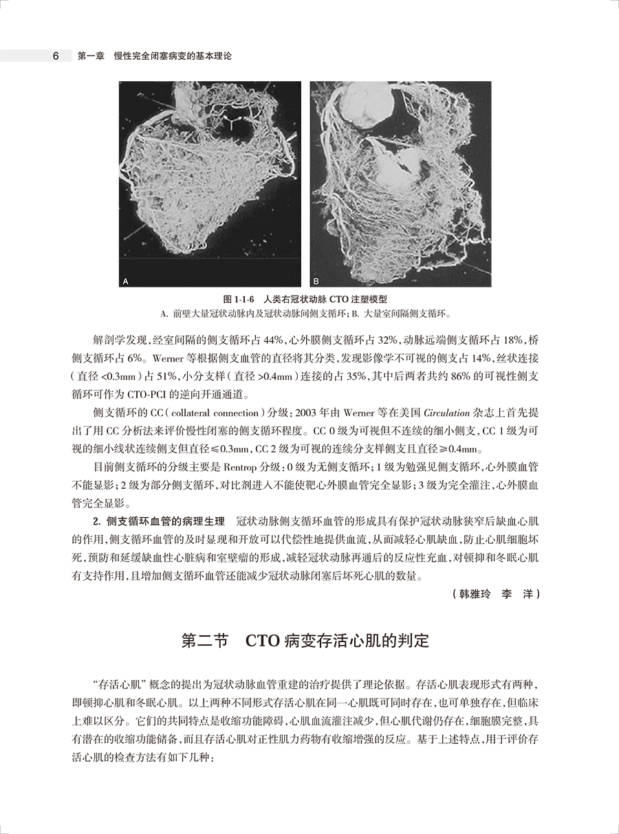 攻克CTO慢性完全闭塞冠状动脉病变介入治疗第2版荆全民等编 OCT病变生理学介入治疗征正向开通技术等操作细节人民卫生出版社-图3