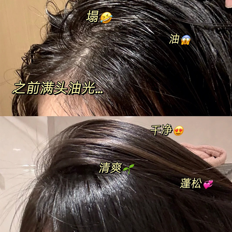 海飞丝控油蓬松头皮护理洗发水去屑舒缓止痒柔顺水杨酸洗头膏男女,淘宝优惠券,粉丝福利购,淘宝优惠卷