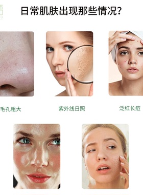 南非欧卡尔Alcare aloe洗面奶Aloe Gel99%补水消痘祛印不紧绷保湿