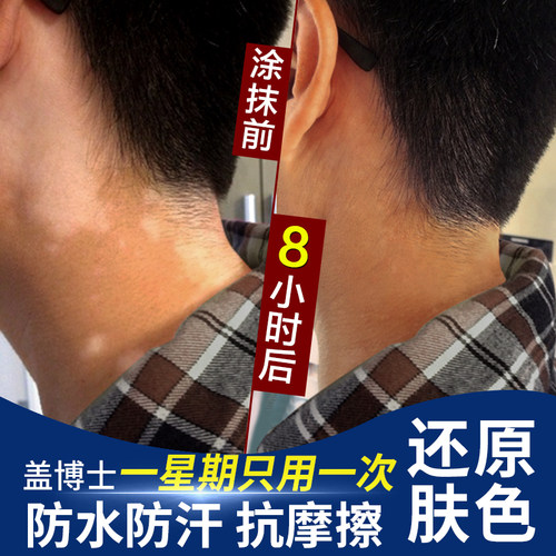 【官方正品】盖博士白癜风遮盖液白斑防水持久肤色遮瑕霜外用防汗 - 图3