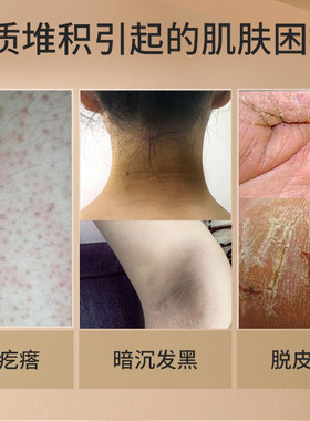 鹤叔推荐宝中宝尿素霜保湿