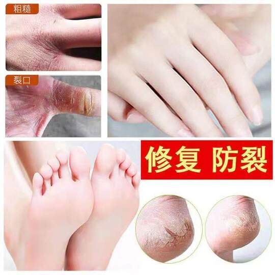Horse oil hand and foot dry, rough, chapped and peeling horse oil cream hand cream anti-crack and antifreeze cream winter hand protection