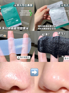 品牌直供柏翠丝鼻贴单片