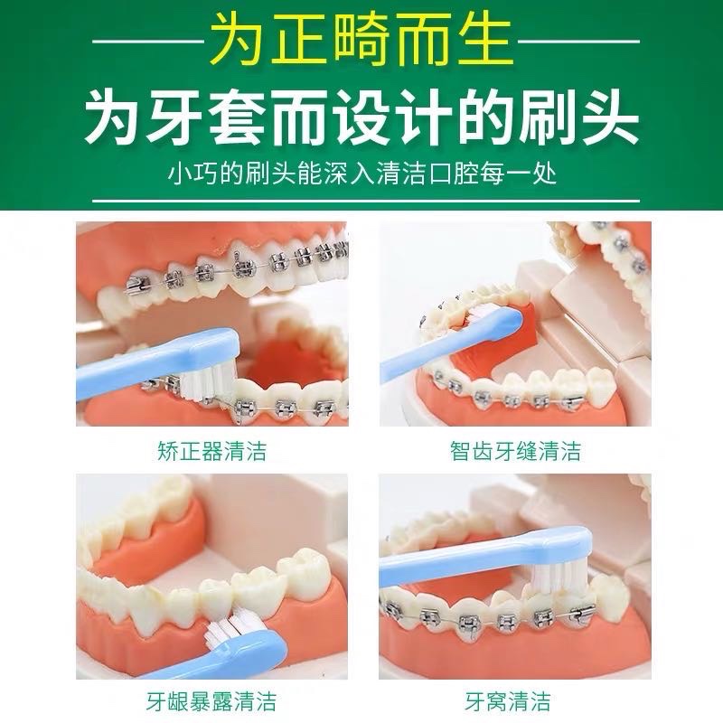 日本进口ci成人矫正正畸牙刷托槽清洁小尖头齿科口腔清洁色素