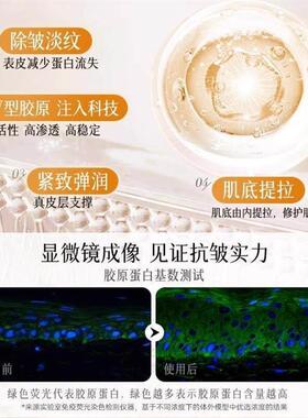 玻尿酸钠抗皱睡眠纹贴细纹法令纹抗皱贴正品