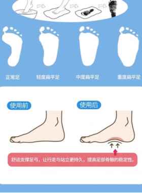 儿童足弓矫正鞋垫扁平足外翻训练