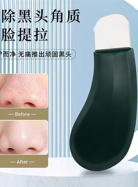 黑头铲子手动黑头刮板面部粉刺黑
