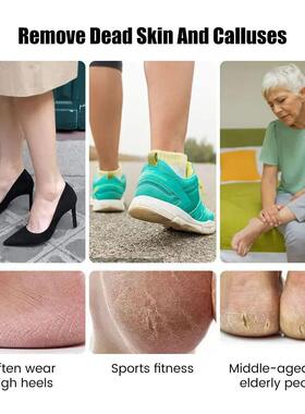 Portable Foot Grinder Feet File Electric Callus Remover Pedi