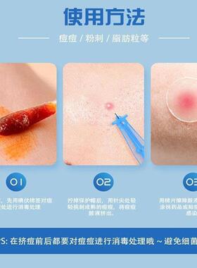 粉刺针闭口一次性去排针清无菌工具痘痘挤挑痘排痘挑刺专用黑头