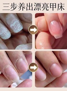 商超同款护甲膏增厚霜防倒刺指甲养厚修复薄软开裂硬液营养指缘油