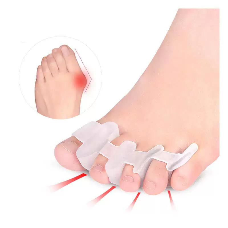 Toe valgus sebs toe separator for adult toe splitter day and night, big foot bone, toe relieving pressure customization