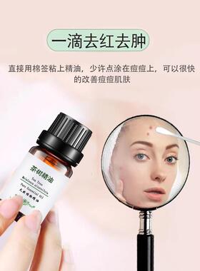 高档纯精油面部油控制痤疮树面部按摩皮肤护理单侧树收缩茶毛孔正