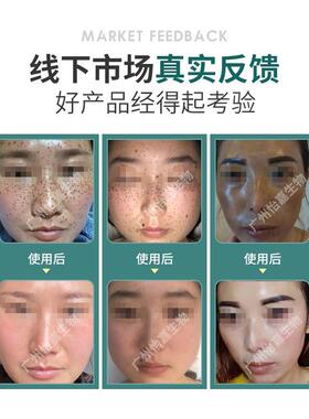 传明酸焕颜霜 去祛淡抽色雀斑真皮斑色素回流晚霜脱皮绿霜控色霜
