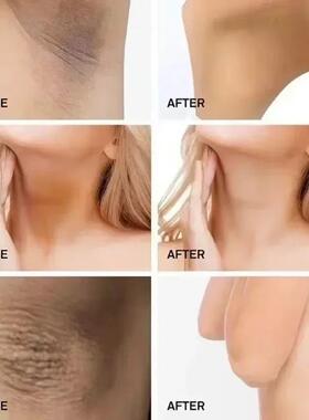 Body Whitening Cream Underarm Knee Buttocks Private Parts