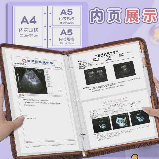 Pregnancy check storage book manual pregnancy file book report single pregnant mother pregnant woman b ultrasound manual prenatal examination report form