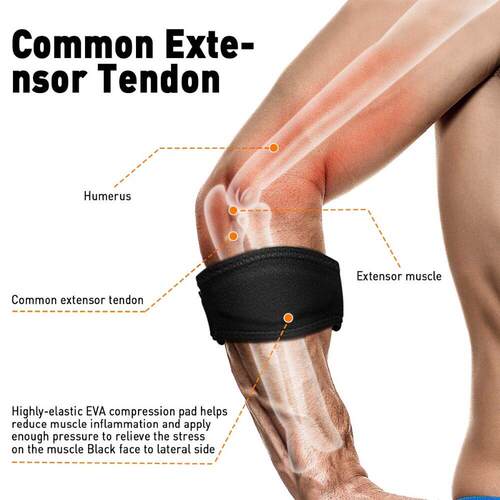 1PCS Tennis Elbow Support Guard Pads Pain Relief Strap Banda - 图2