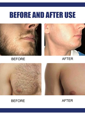 EELHOE Men's Hair Removal Cream - A gentle and effective sol