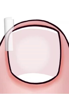 矫正器填充指甲隔离纠正美甲工具