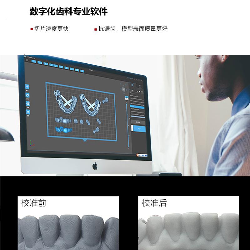 牙科3d打印机光固化齿科门诊高精度临时牙种植导板正畸义齿口腔-图0