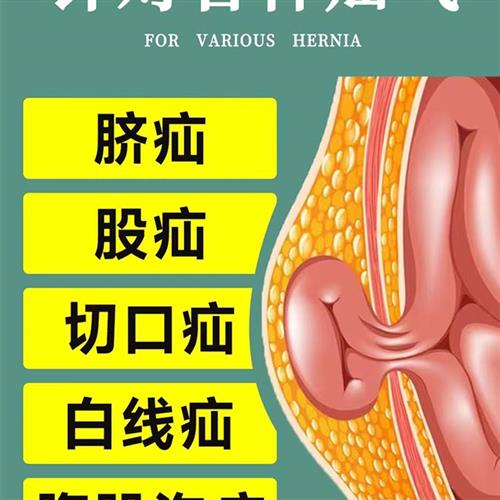 极速疝气贴腹股沟中老年人专用药贴小肠疝气内消丸婴儿凸肚脐疝气 - 图2