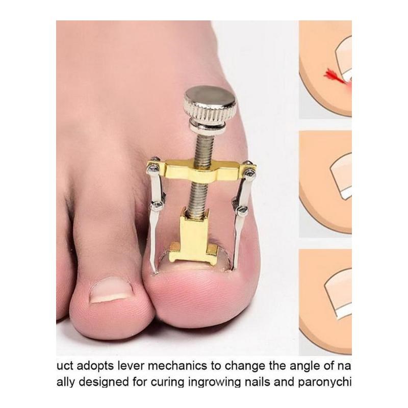 Nail-Recover-Tool Pedicure Ingrown Toenail Foot-Care Nail-Na - 图3