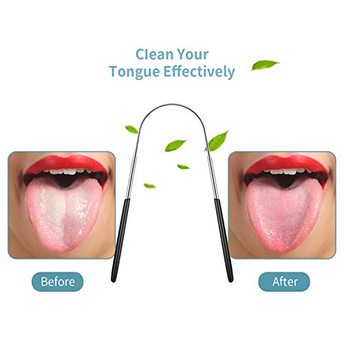 推荐4 Pieces Tongue Scrapers Reduce Bad Breath Tongue Scrape-图2