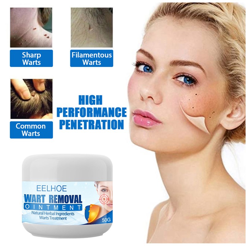 速发Wart Remover Safe Painless Skin Tags Removal Ointment Fa - 图2