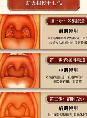 热销儿童张嘴呼吸不通气腺样相体肥大中药儿童嘴贴面容纠正矫正器