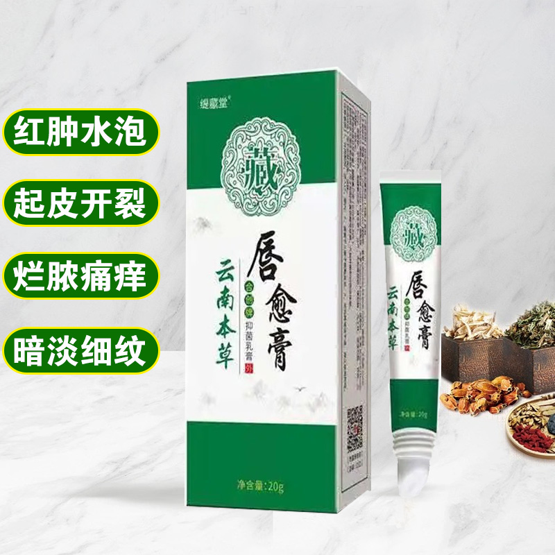 急速发货口唇炎专用药日本唇炎唇膏嘴唇干裂脱皮嘴角开裂润唇膏