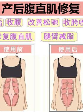 工厂销腹直肌分离l修复贴产后家用仪器训练锻炼器收腹带紧致肚子