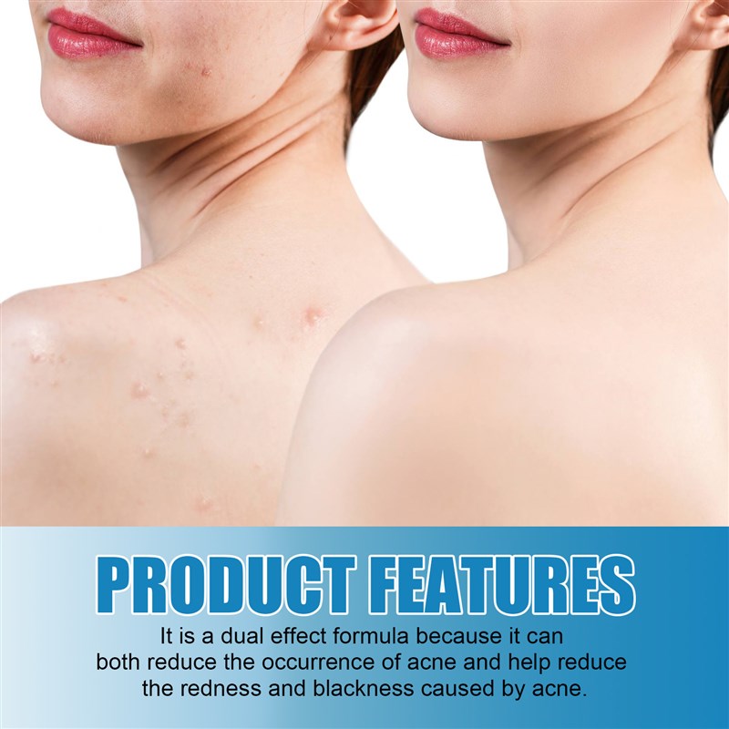 推荐Back Acne Treatment Spray Redness Calm Soothe Pores Shri-图3