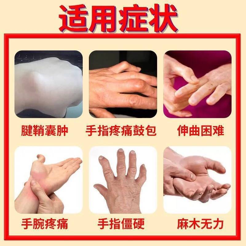 网红腱鞘炎专用膏【三天可裉除】手指疼消除神器大拇指关节疼痛特 - 图3