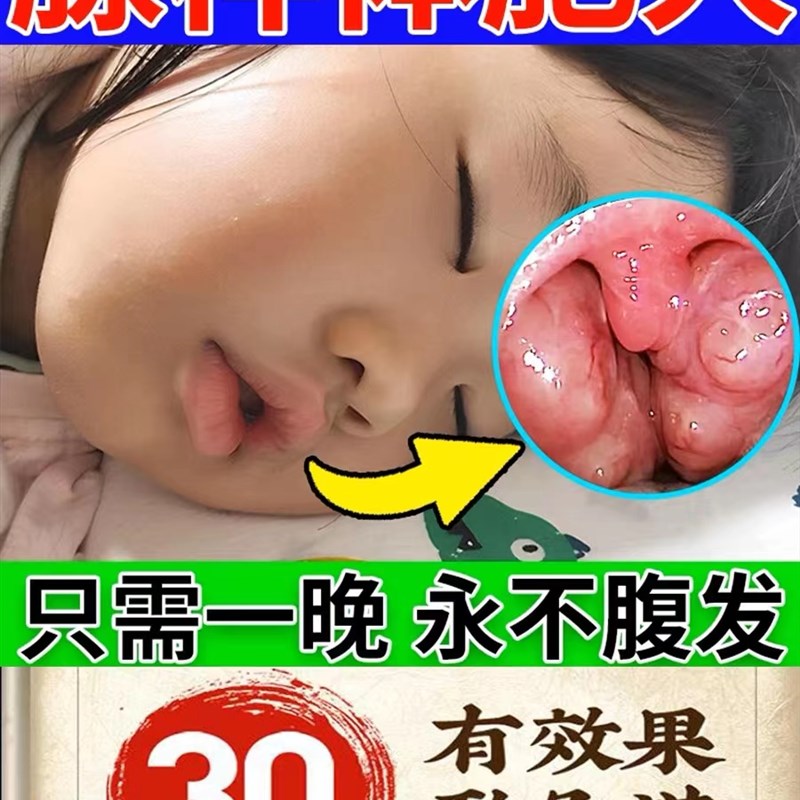 【打快三天】腺样体肥呼草本贴膏儿童张M嘴大吸调理男女最呼噜 - 图0