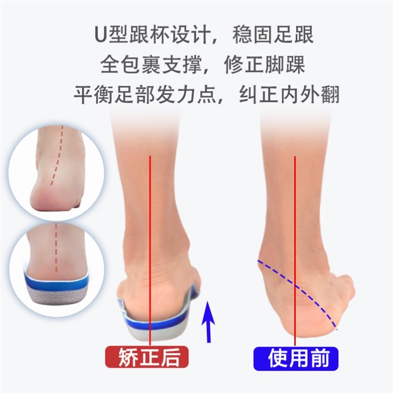 儿童矫正鞋垫足外翻矫正器足弓塌陷支撑脚垫纠正扁平足XO腿内八字 - 图2