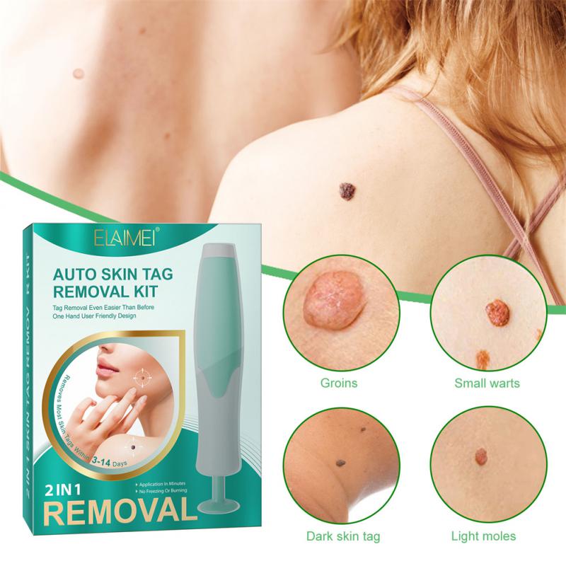 极速Auto Skin Tag Remover Painless Mole Wart Remover Skin Ta-图1