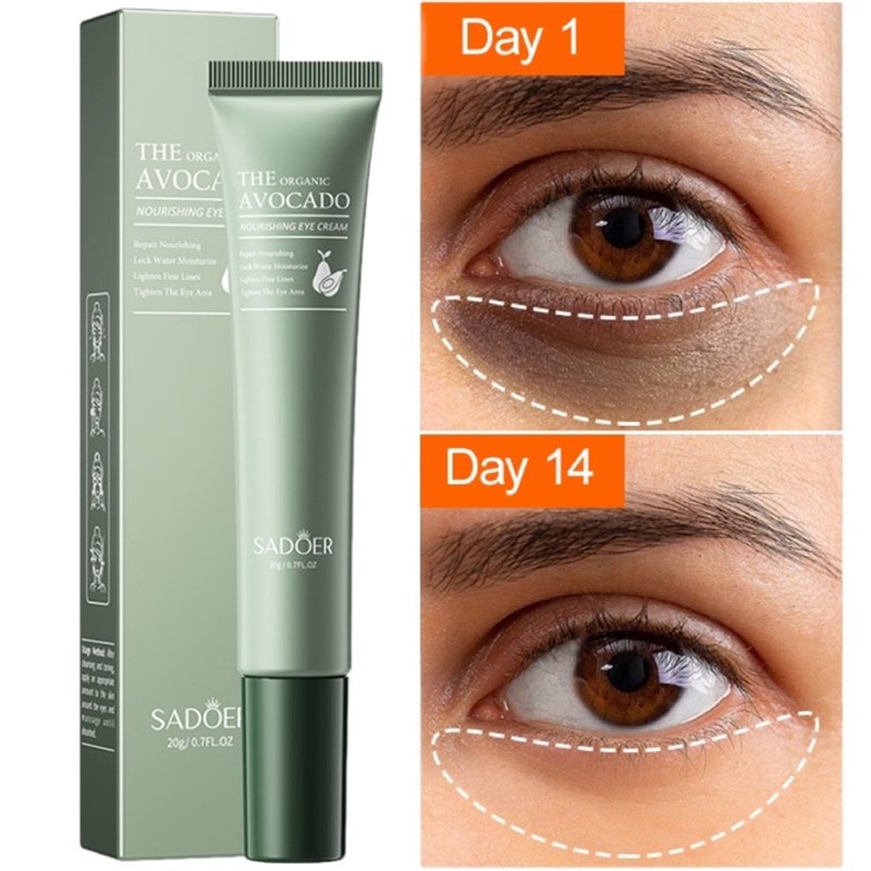 极速Eye Cream Quickly Lightens Dark Circles Under The Eyes - 图0