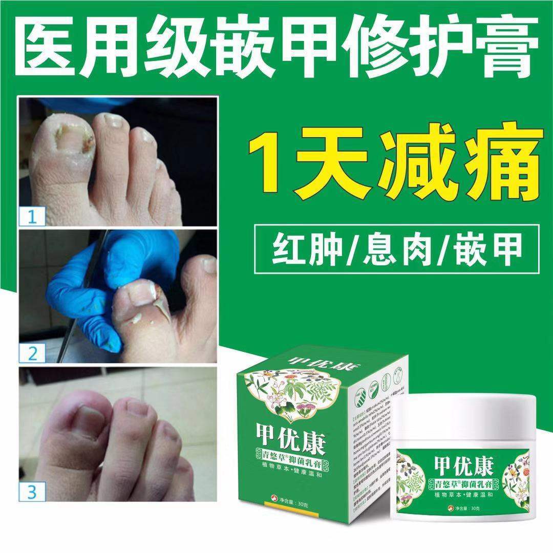 网红甲优康青悠草抑菌乳膏买2送1 3送2 5送4w-图0