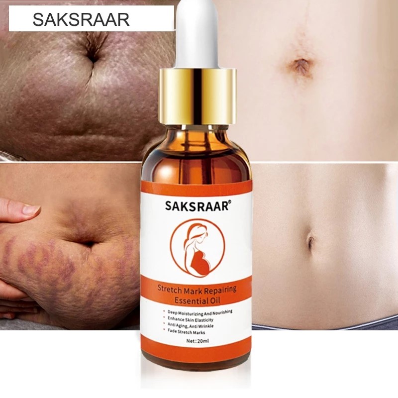 推荐Stretch Marks Remover Essential Oil Skin Care Treatment - 图1