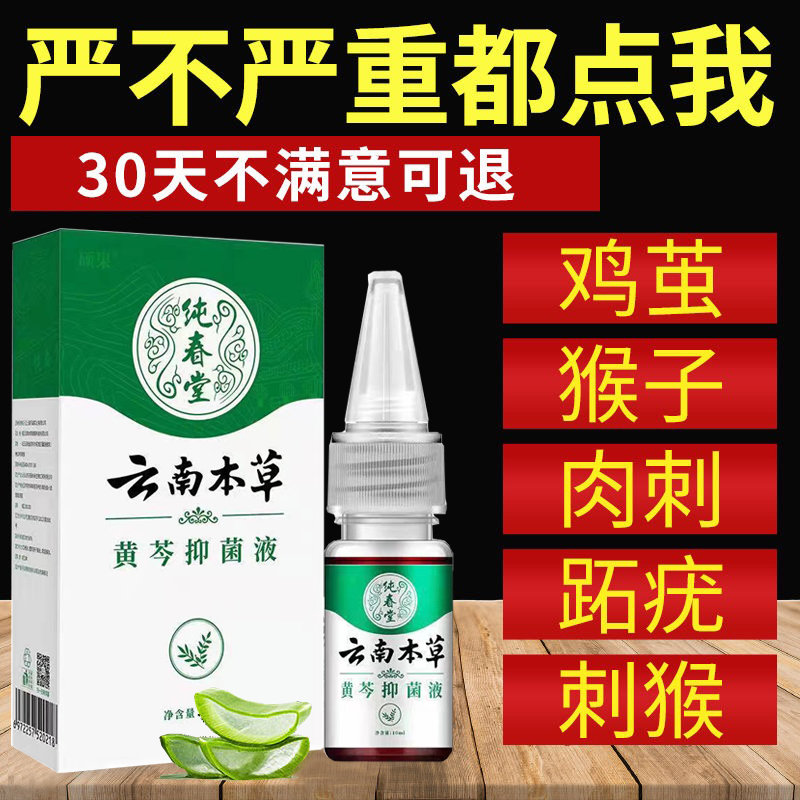 现货速发云南本草黄芩手足趾尤精华液趾尤去跖尤净膏鸡眼膏贴肉刺 - 图0