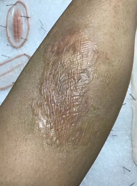 刀疤胶塑形胶老疤特效化妆仿真伤效烧伤毁容妆增生刀疤脸接边胶