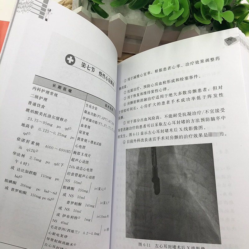 正版 心内科医嘱速查手册 陈步星 实用内科疾病临床处理手册 临床处方大查房心内科新医师手册 临床医学心血管 内科临床医学书籍 - 图3