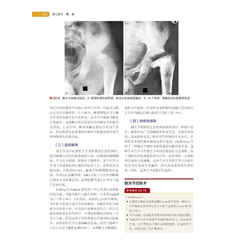 坎贝尔骨科手术学第14版第2卷(感染·肿瘤·儿童骨科)外科手术技术书籍骨科权威著作北京大学医学出版社正版书籍9787565925627-图2