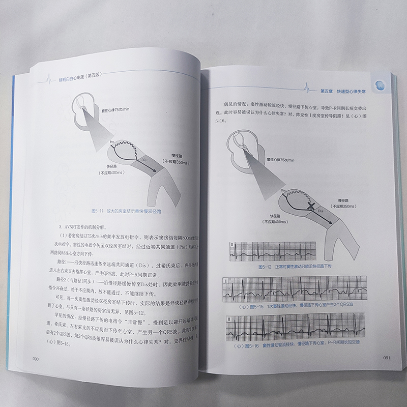 明明白白心电图(第五版)第5版 心电图诊断书籍临床心电图图解速成超声基础学入门影像诊断学 广东科技出版社正版书籍9787535979773 - 图2
