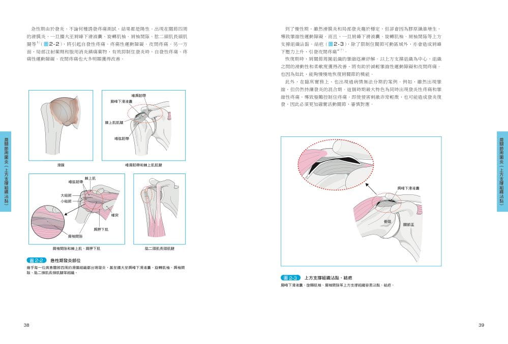 预售正版 赤羽根良和肩关节挛缩的评估与运动治疗 临床篇枫叶社文化  医疗保健 原版进口书