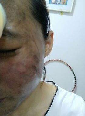 千百黛超声波美容仪导出排毒胶囊