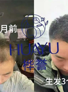 桦誉新品植萃套人参养发液正品