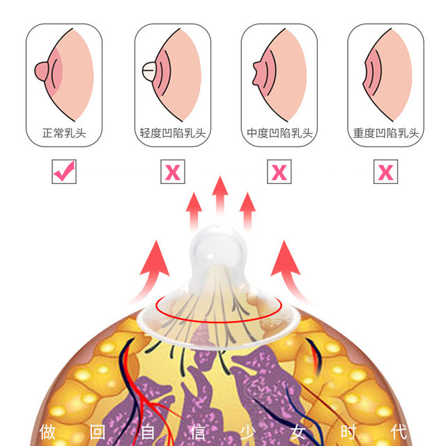 Nipple corrector has good physical correction effect