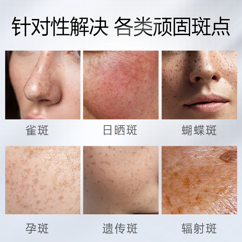  瑜然美化妆品液态精华