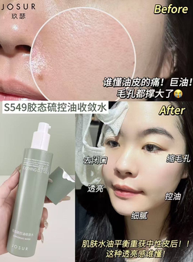 JOSUR/玖瑟胶态硫卓效控油保湿祛痘修护收敛水毛孔粗大油痘肌
