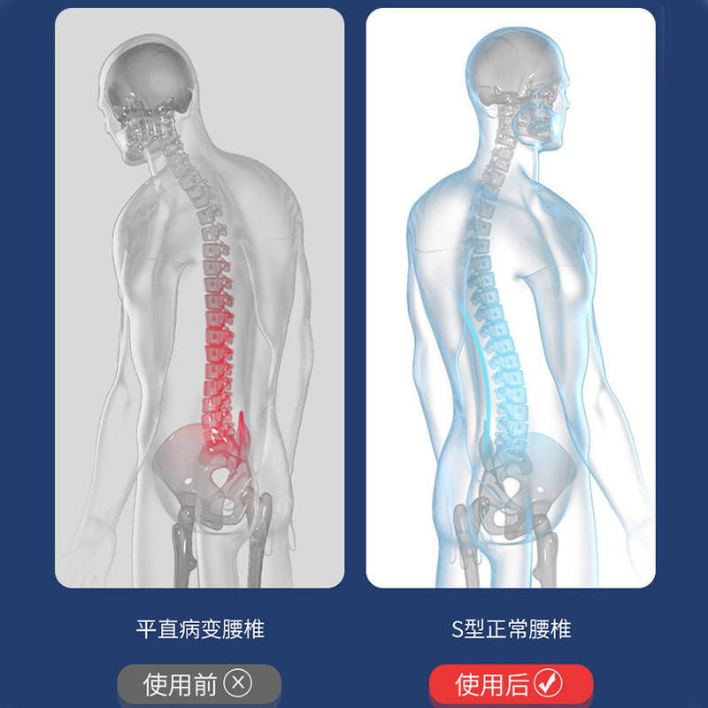 腰枕腰间盘突出睡觉腰垫腰肌劳损腰疼神器腰托腰部支撑平躺靠垫椎 - 图1